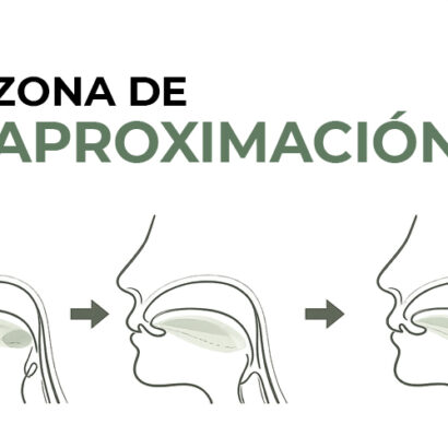 ¿Qué es la Zona de Aproximación?